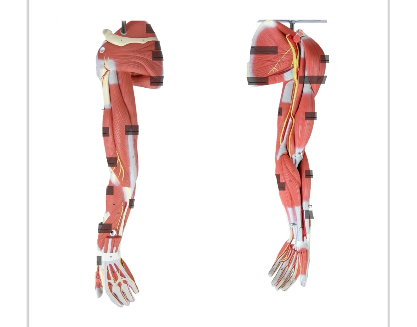 Arm Muscles Labeling — Printable Worksheet