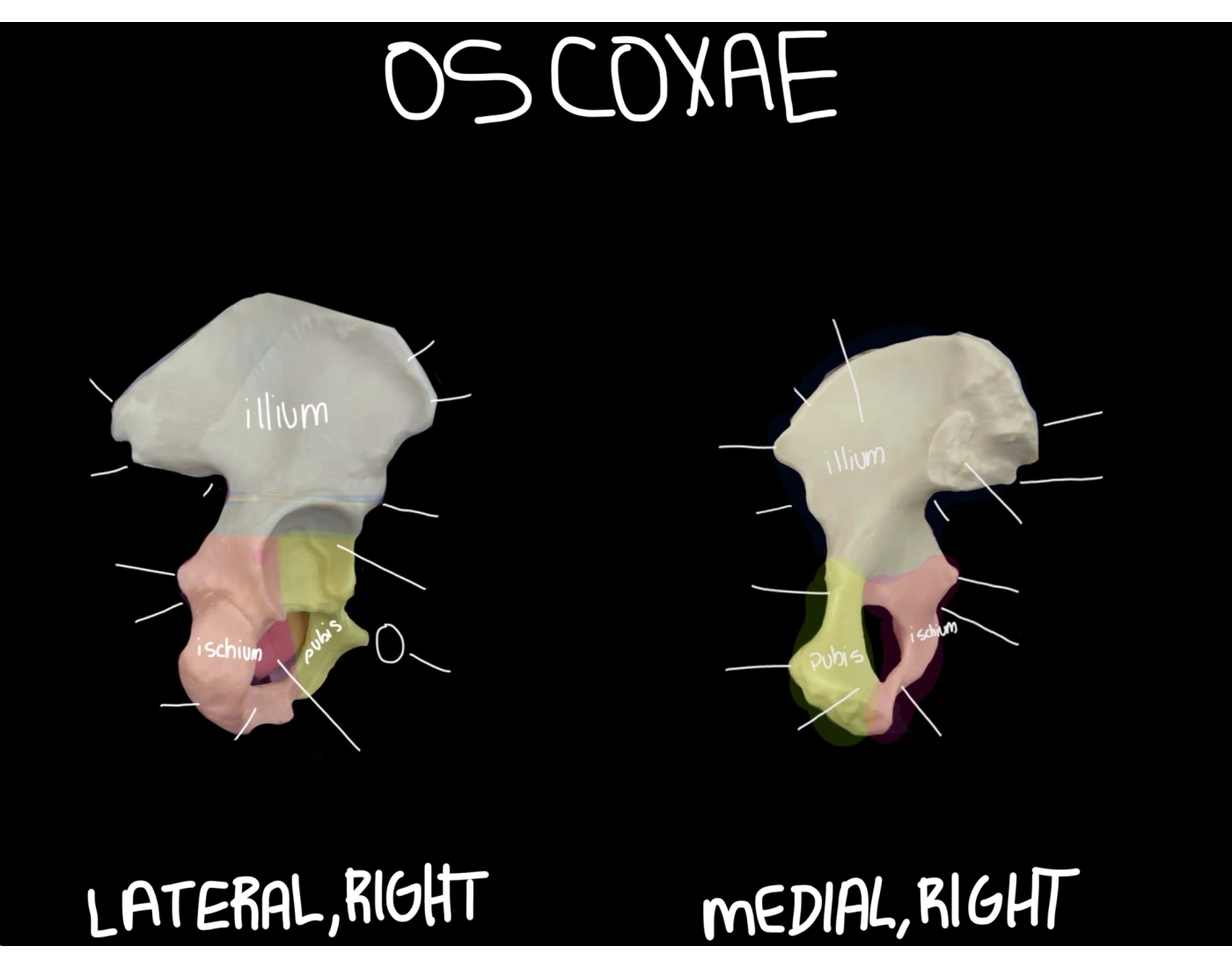 Os Coxae (hip bone) Quiz