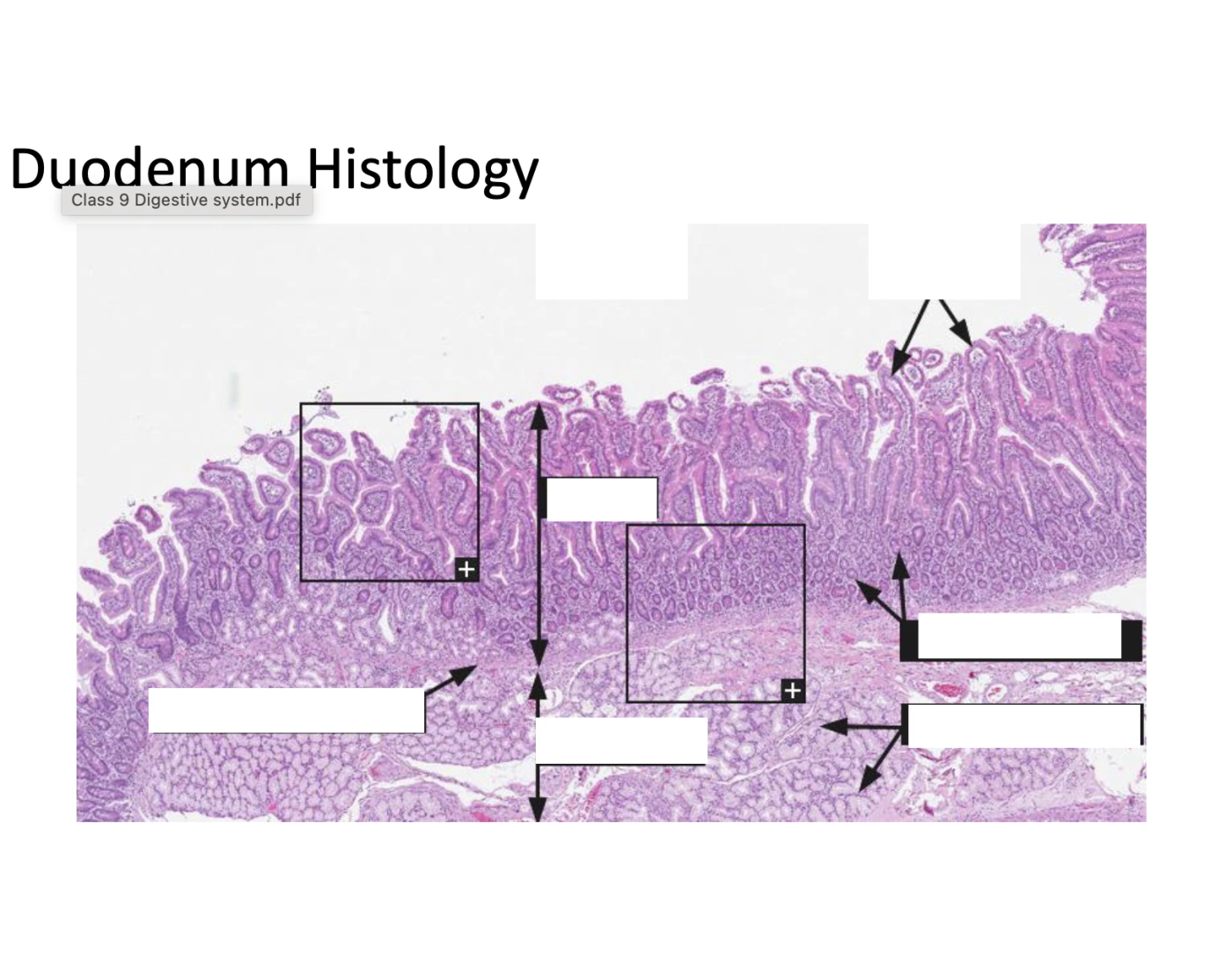 Duodenum Histology Quiz