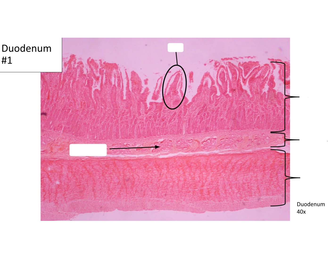 Duodenum #1 Histology Quiz