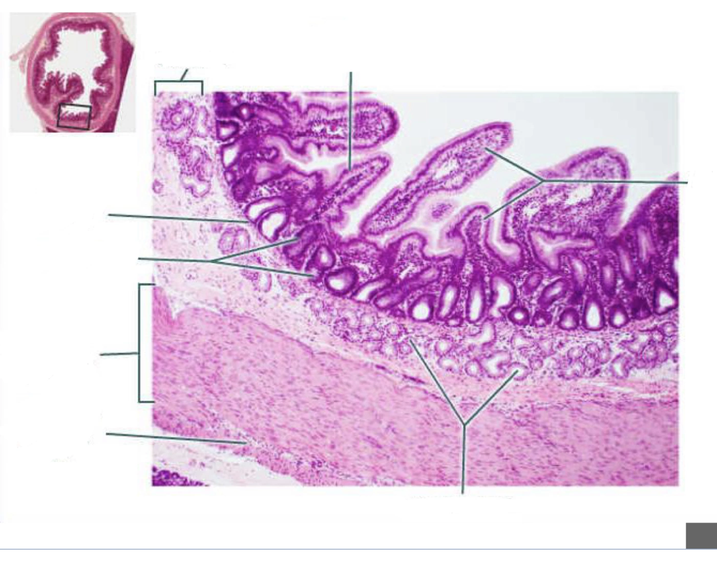 Duodenum;cross section 100x Quiz