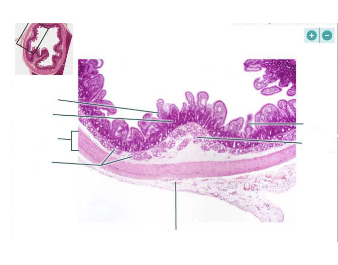 Duodenum;cross section 40x Quiz