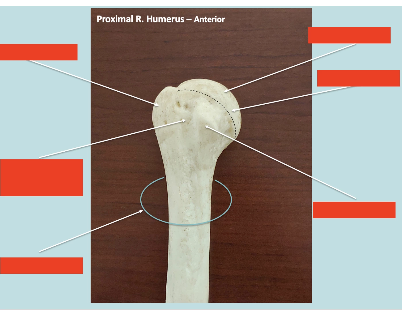 Promixol R Proximal R. Humerus — Printable Worksheet