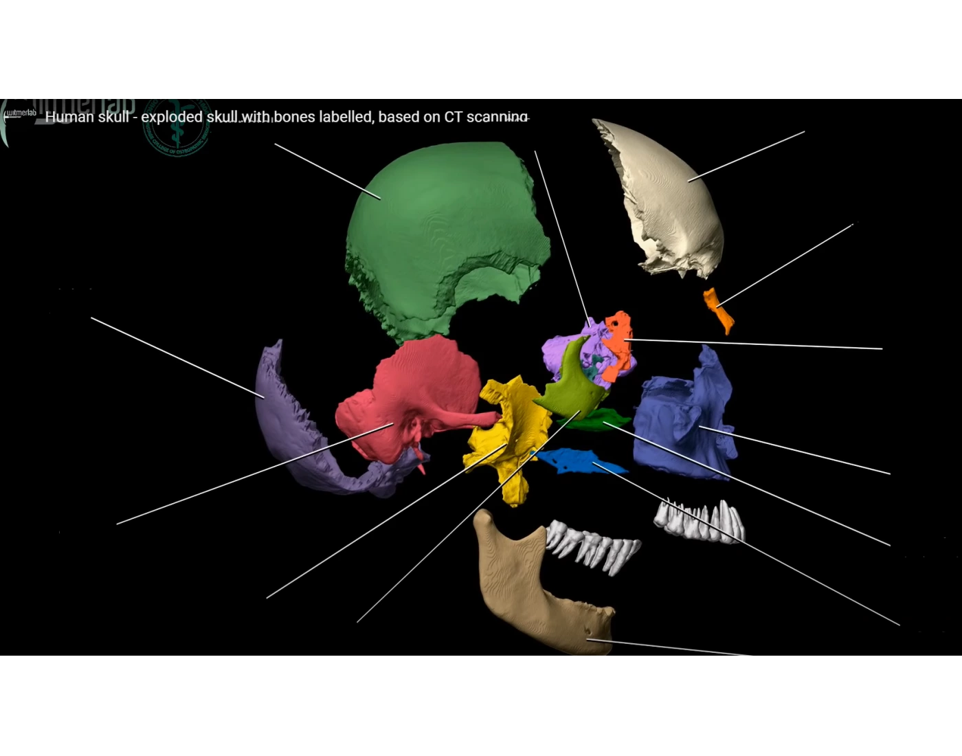Human Skull - Exploded skull with bones Quiz
