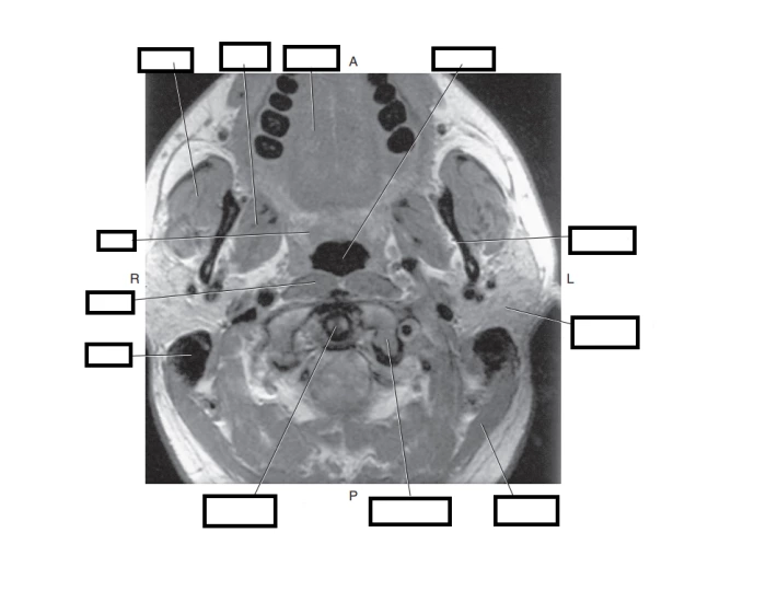Sectional Anatomy 5.1 Part 1.3 Quiz Biology Diagrams