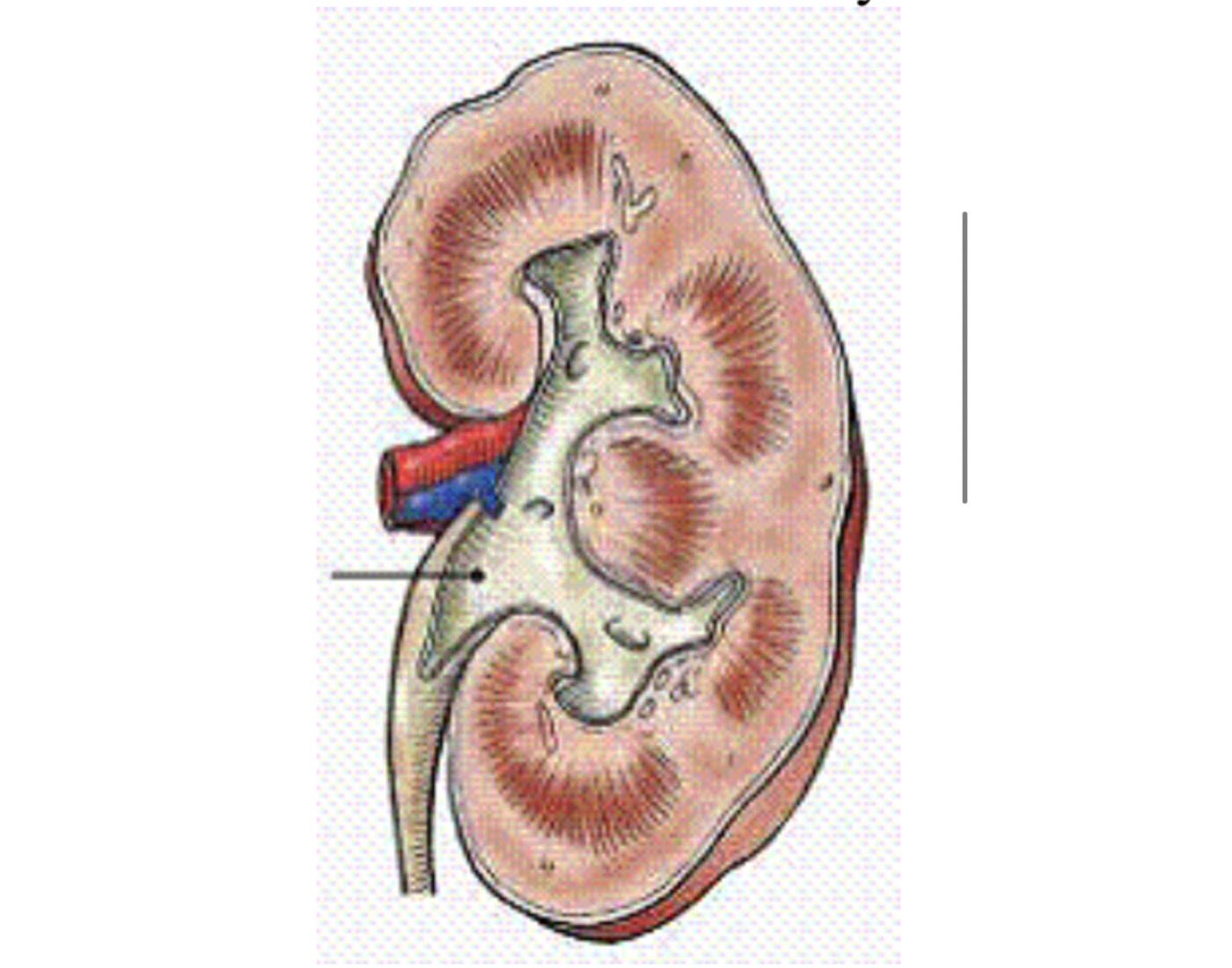 Midcornal midcoronal section of kidney Quiz