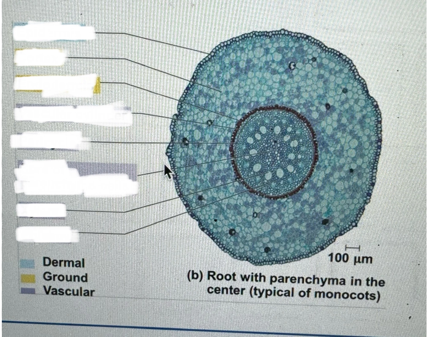 Protoxylem Root Xylem And Phloem