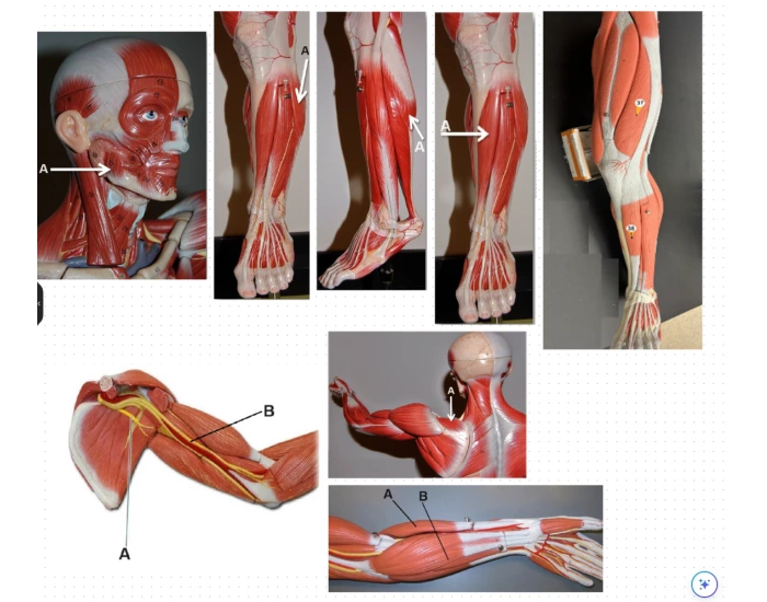 Computer Muscle Anatomy Lab Muscles (PART 1) Quiz
