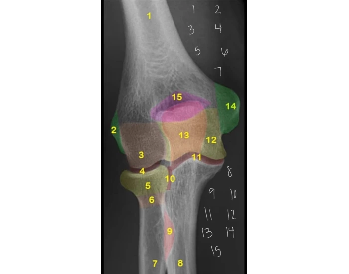 AP elbow anatomy color coded Quiz