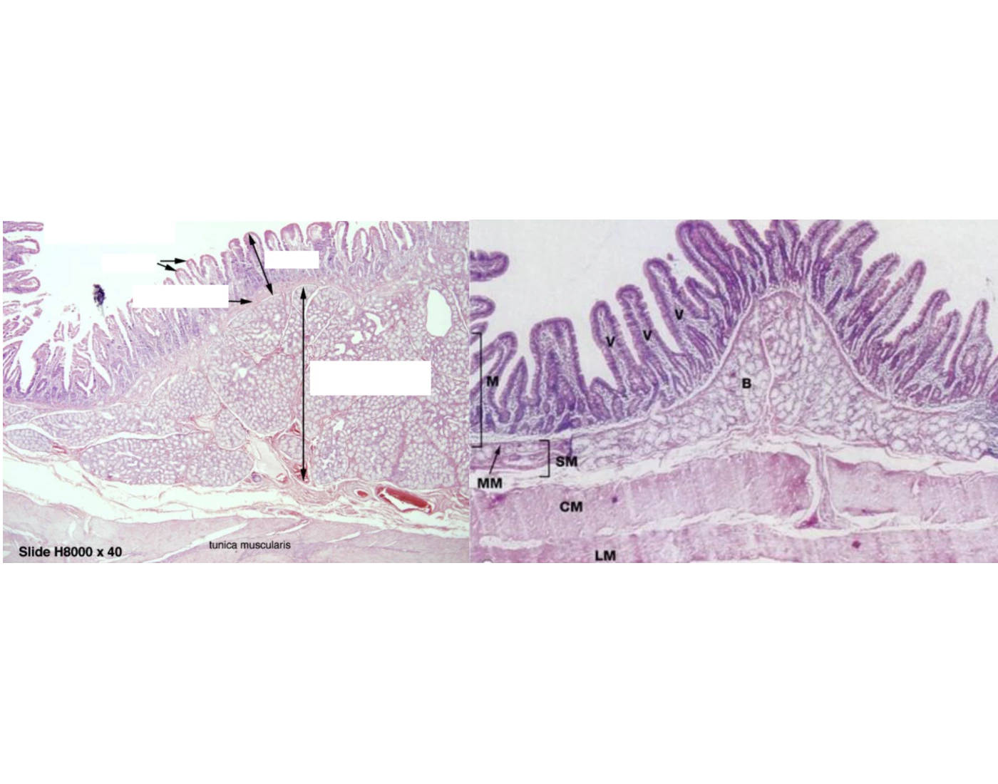 Duodenum Histology Quiz