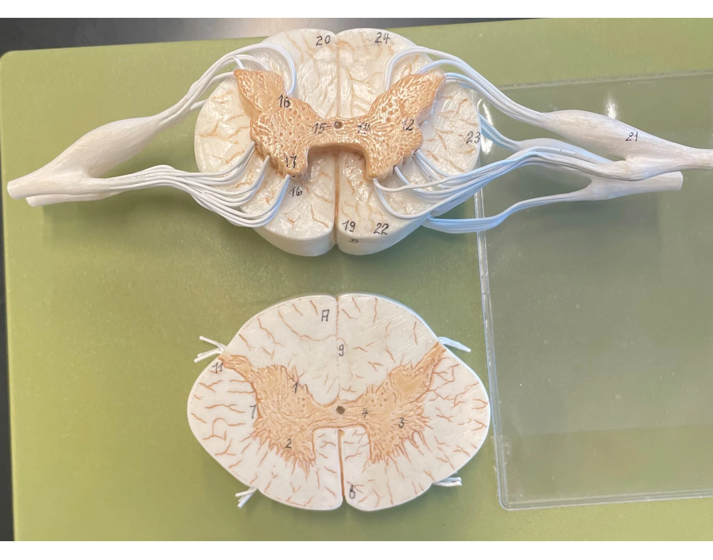 Cross Section Lab Model human spinal cord cross-section model — Printable Worksheet