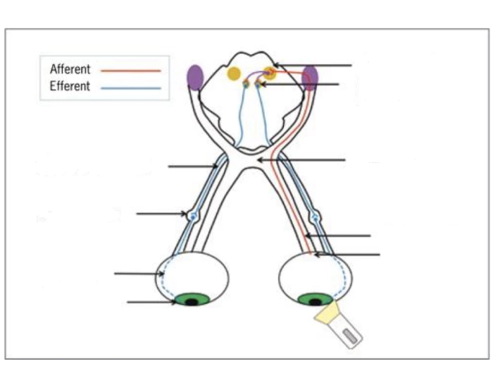 Visual Pathway 2 — Printable Worksheet