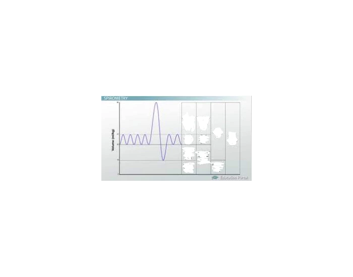 Spirogram Labelling Quiz