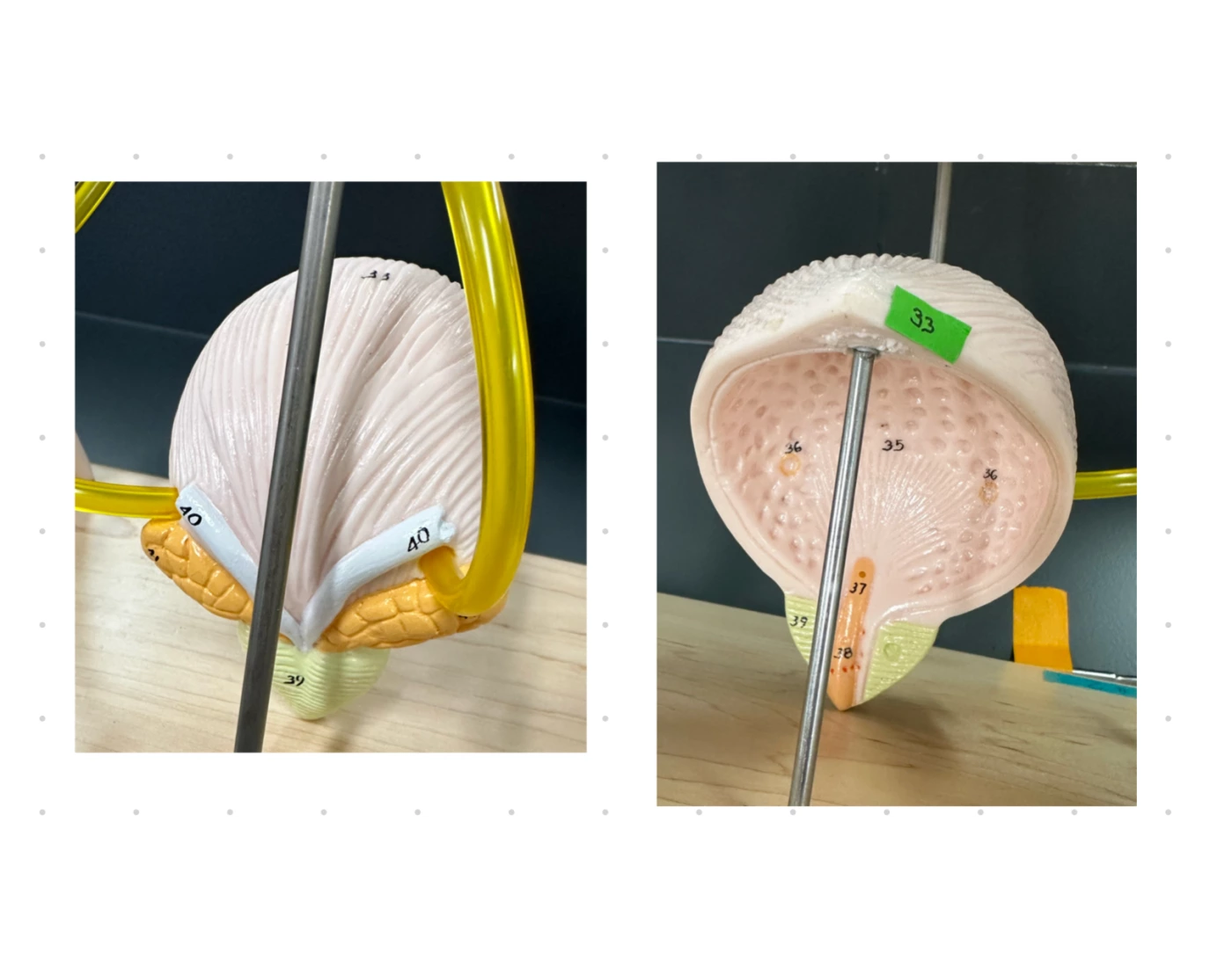 Endoscopic Bladder Model Urinary Bladder Model Quiz