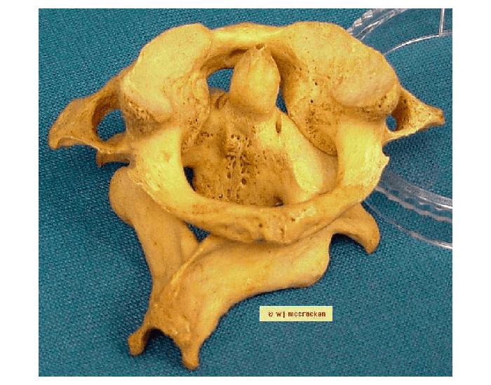 Labeling C1 C2 Vertebrae Quiz