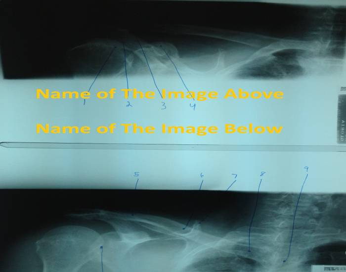 Shoulder Anatomy 4 Quiz
