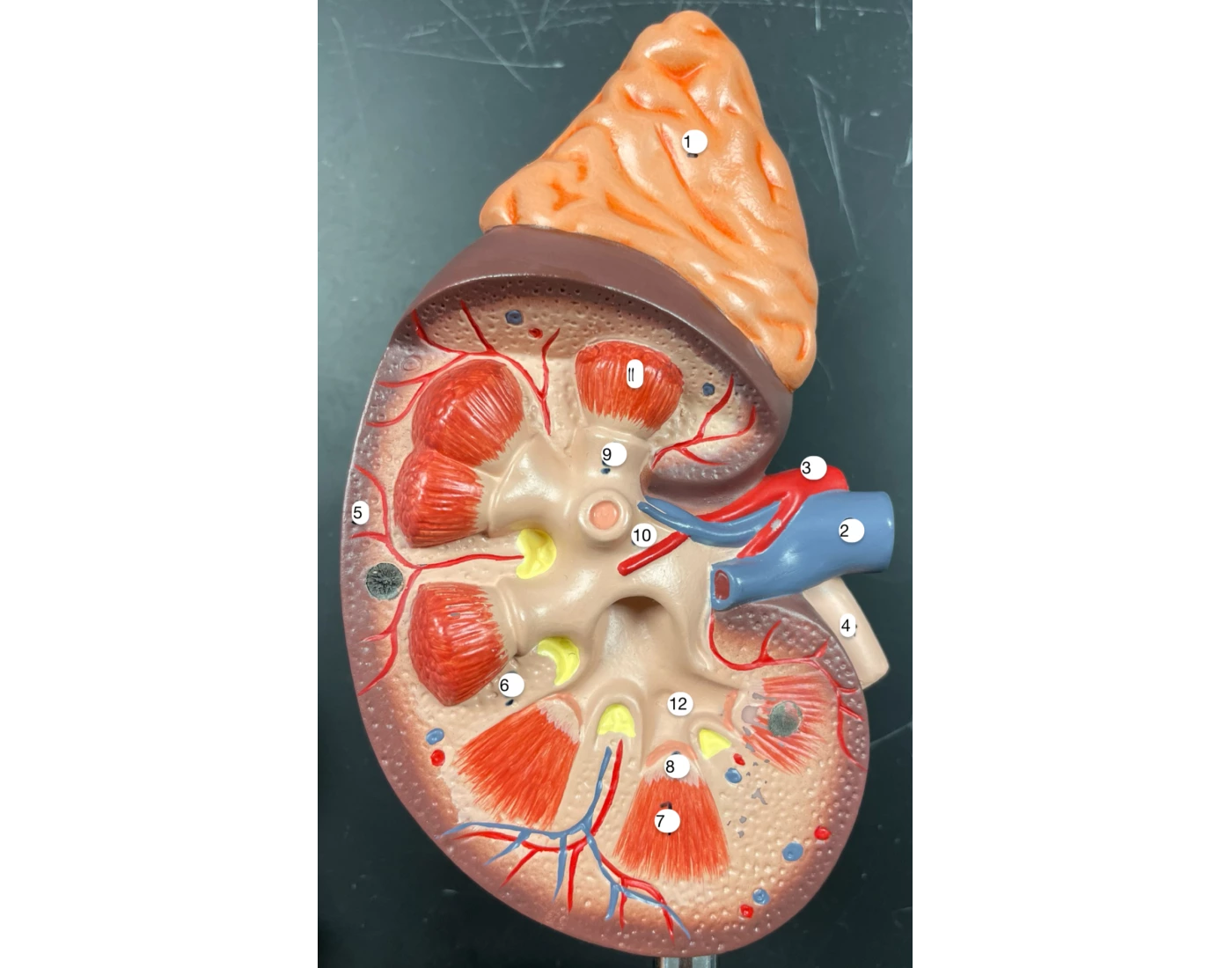 Kidney Display Kidney display (individual one) Quiz