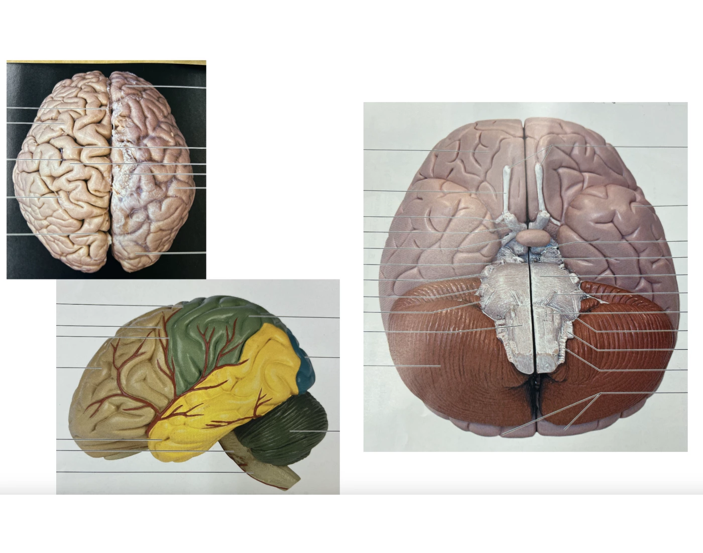outer brain views -- superior, inferior, lateral Quiz