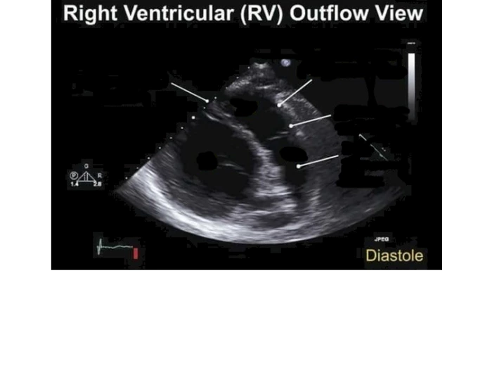 Small Rvot RVOT LABELING QUIZ