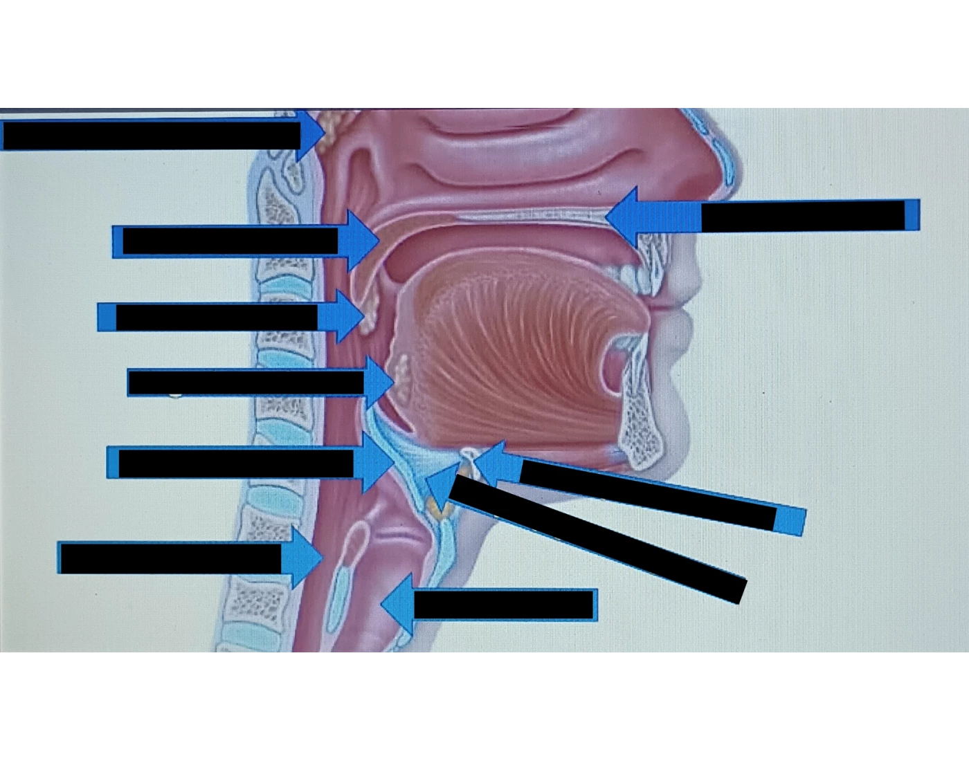 Upper Airway Anatomy Part 2 Quiz Upper Airway Anatomy Part 2 Quiz