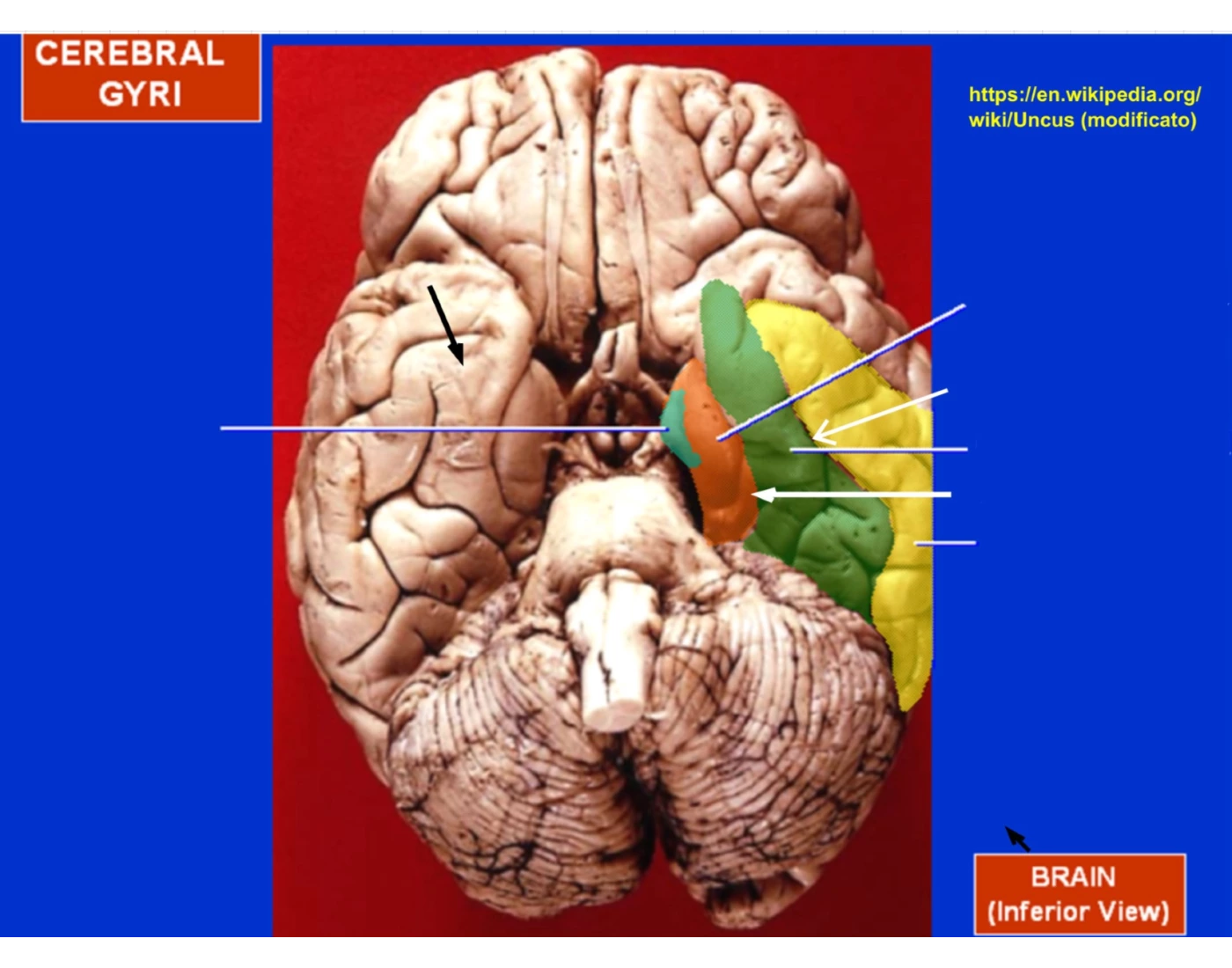 Cerebral gyri Quiz