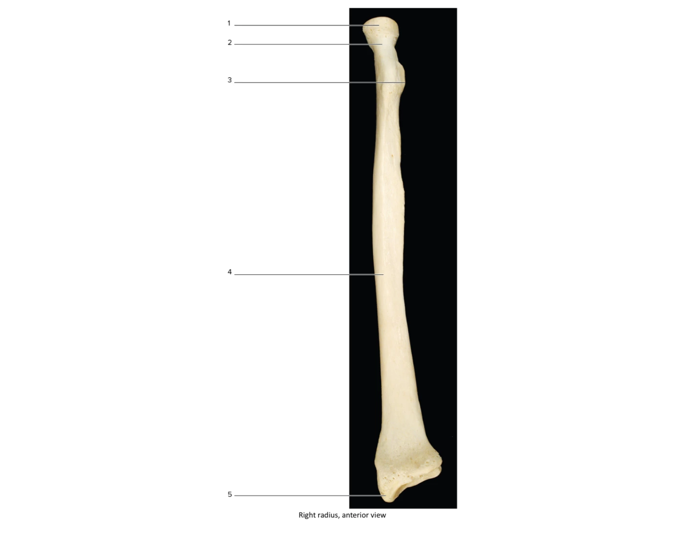 Right radius, anterior view Quiz