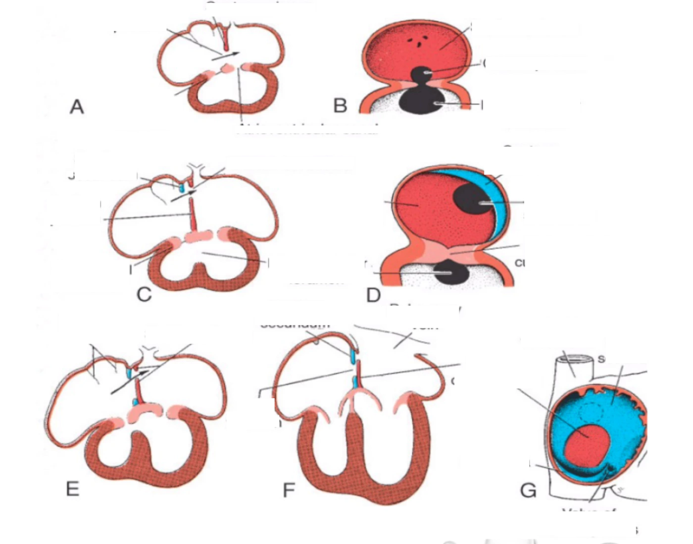 Septal Formation in the Common Atrium — Printable Worksheet
