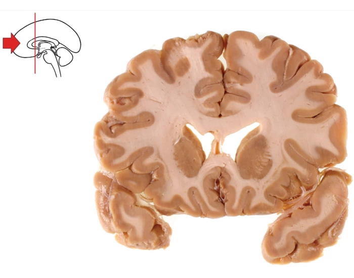 Cerebral Cortex Worksheet Cerebral Cortex Cross section 1 — Printable Worksheet