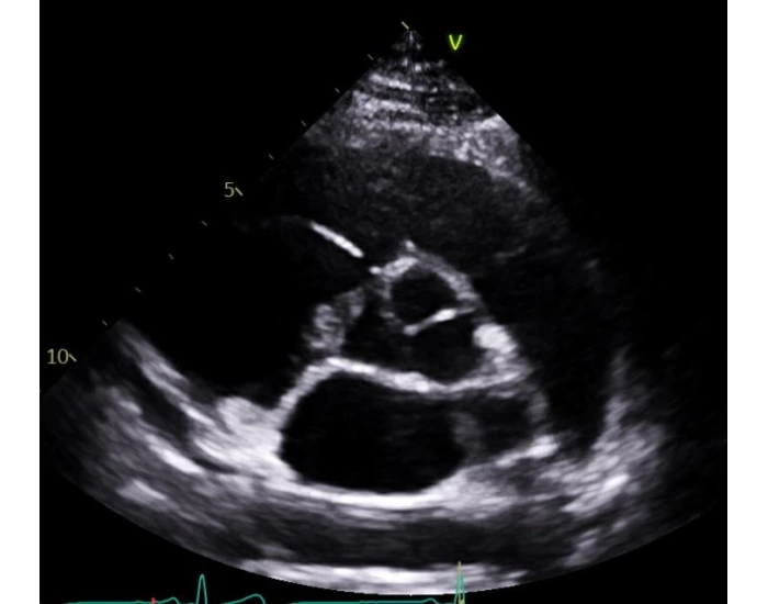 Psax Labels Echo Views: Parasternal Short Axis (PSAX) - Base Quiz