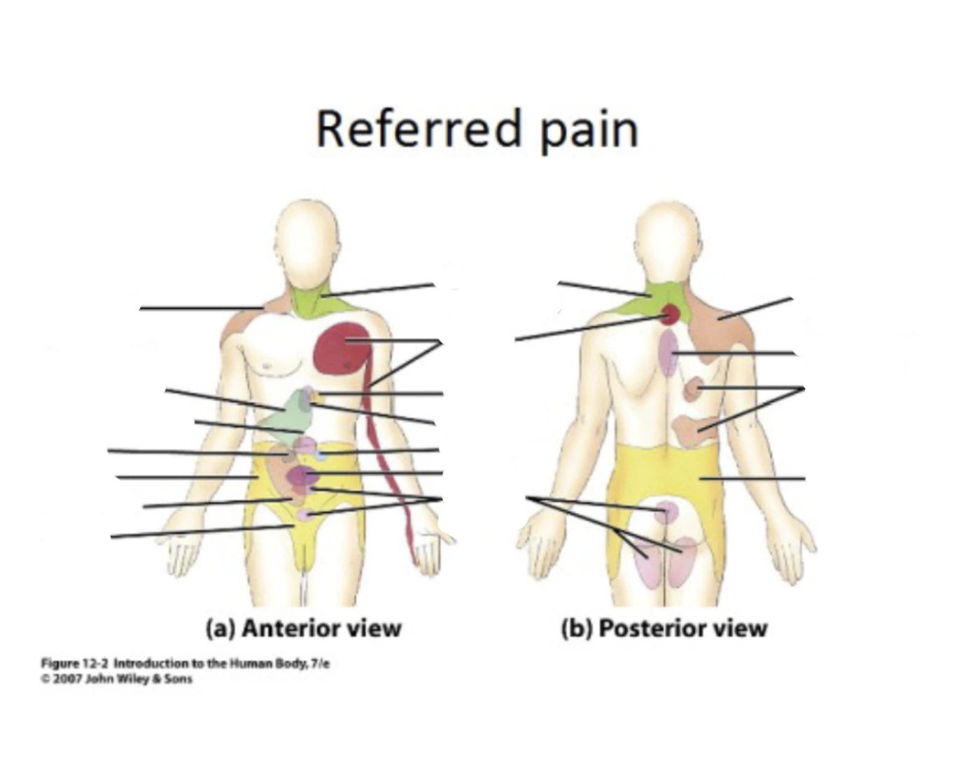 Referred Pain MU 27 Quiz