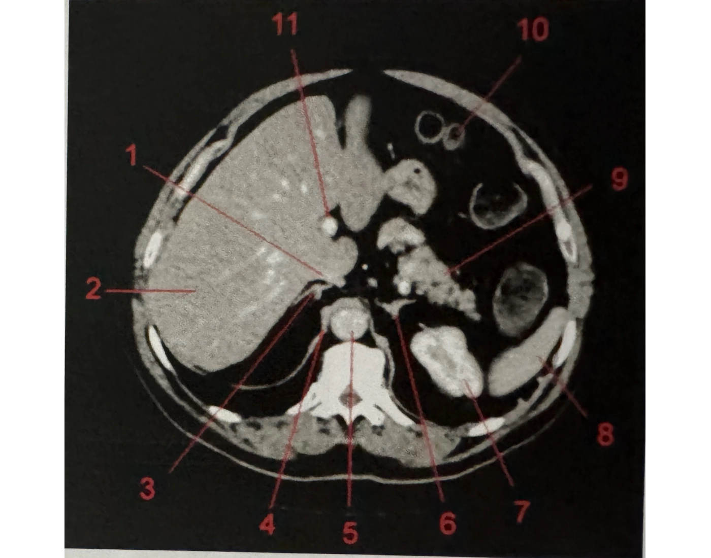 Ct Scan Worksheet.pdf CT scan anatomy — Printable Worksheet