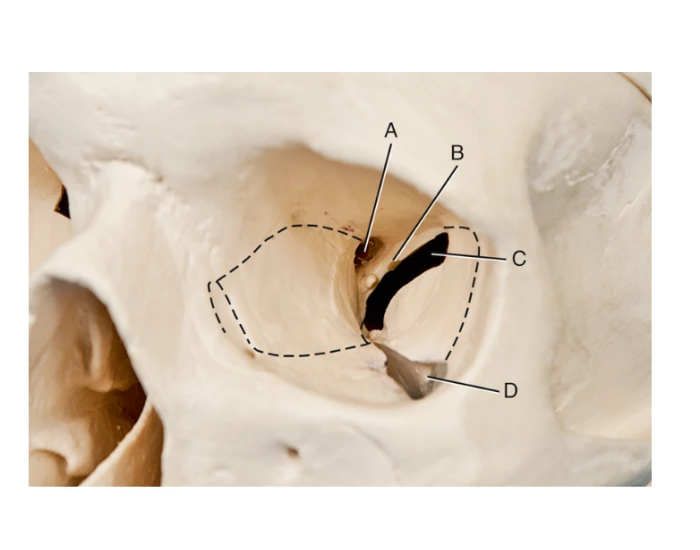 Openings and structures of left orbit Quiz