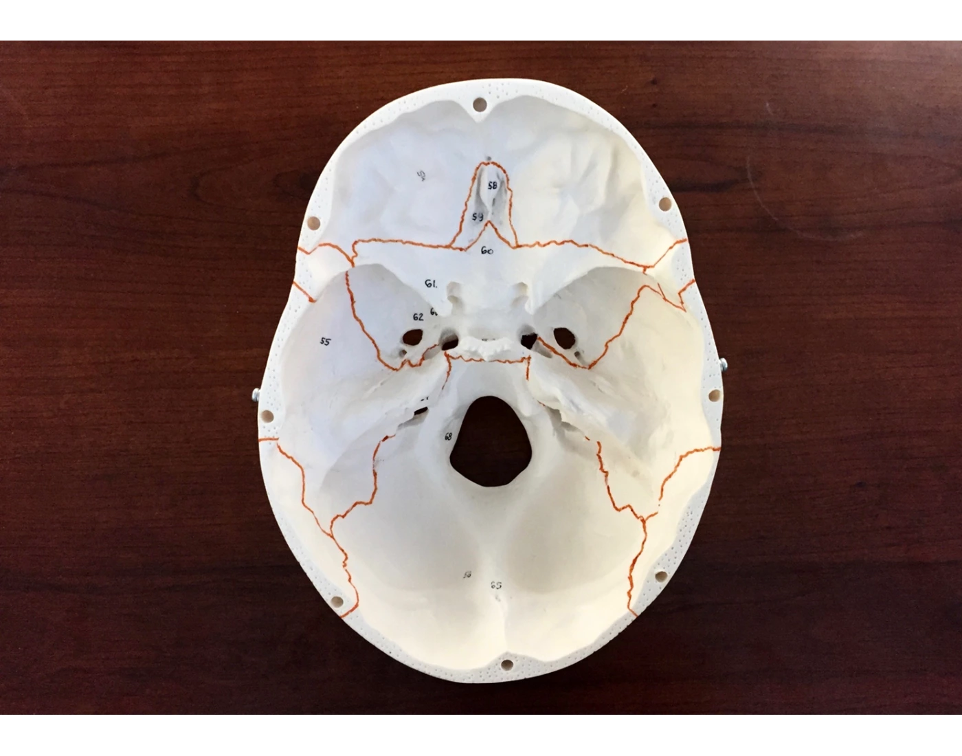 Bones/Structures of the Skull (Superior/Interior) Quiz