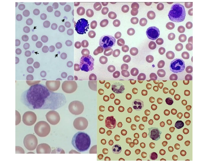 Formed Labed Lab 1: Hematology Formed Elements Labeled Quiz