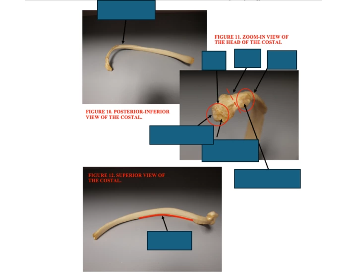 Osteology: Ribs/Costals — Printable Worksheet