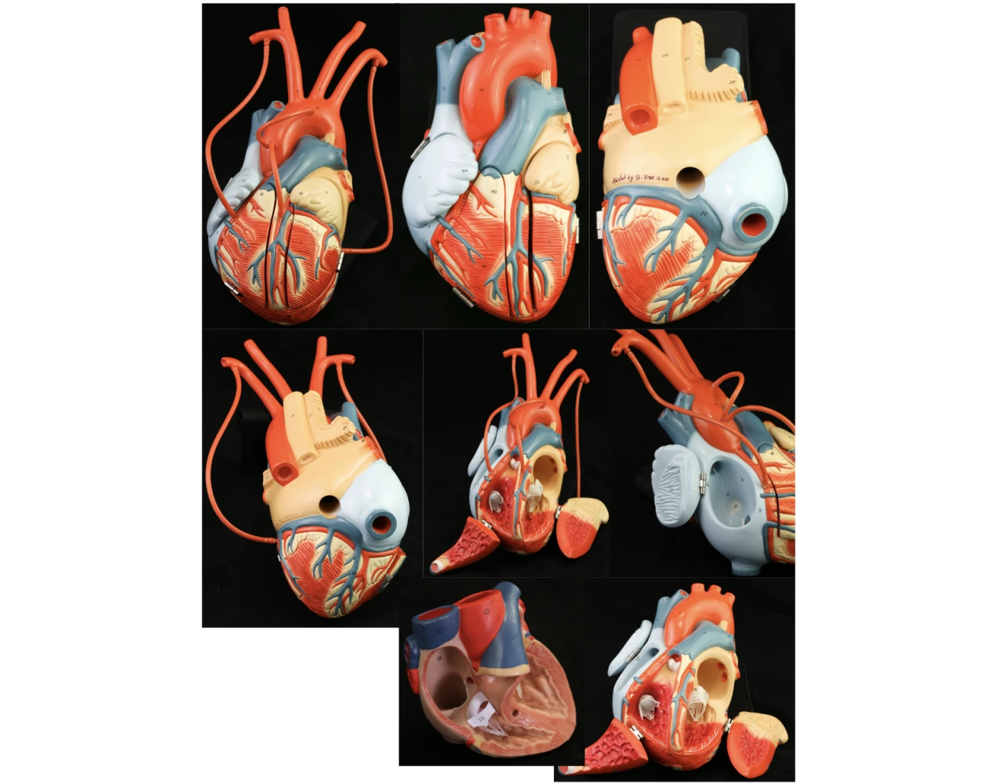 Lab 2: 3D Heart Labeling Quiz