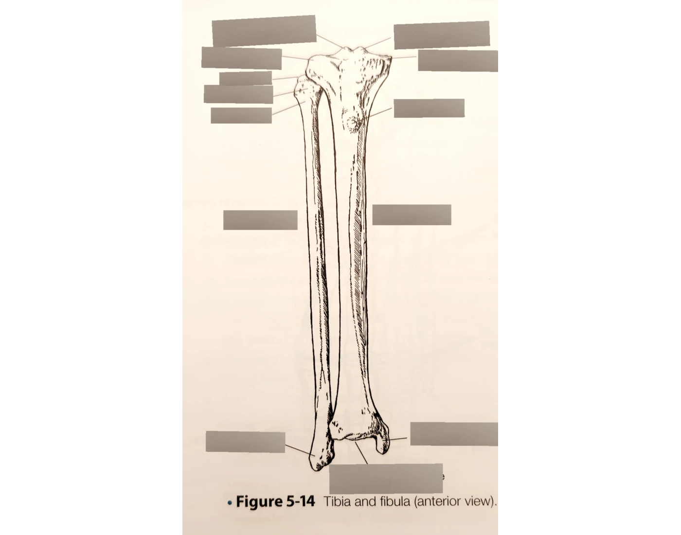 Tibia and Fibula AP Quiz