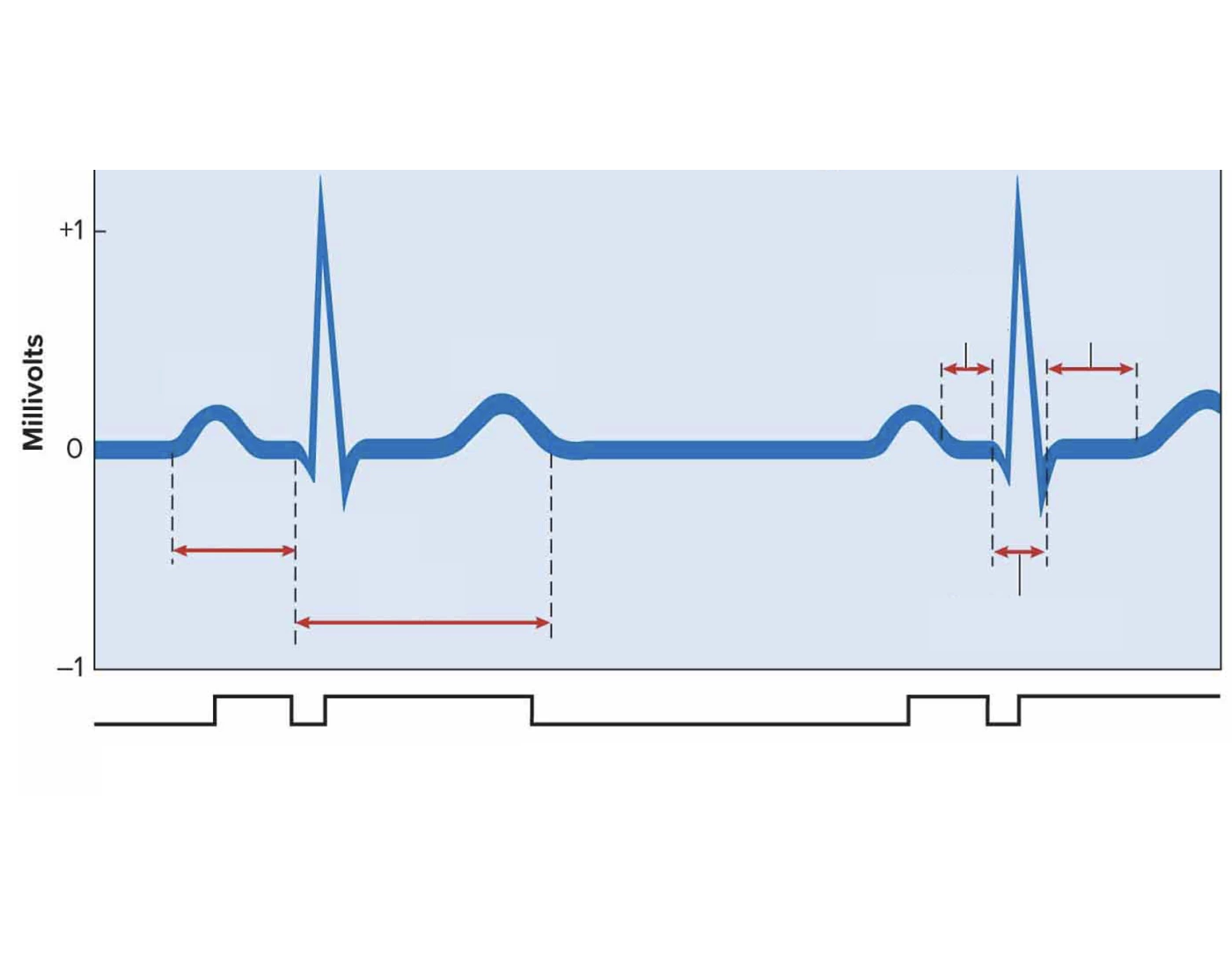 Normal Ecg Graph The Heart | Normal ECG Graph Quiz