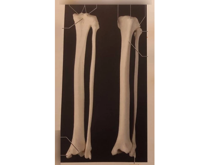 Cat Tibia / Fibula - 2025 Quiz