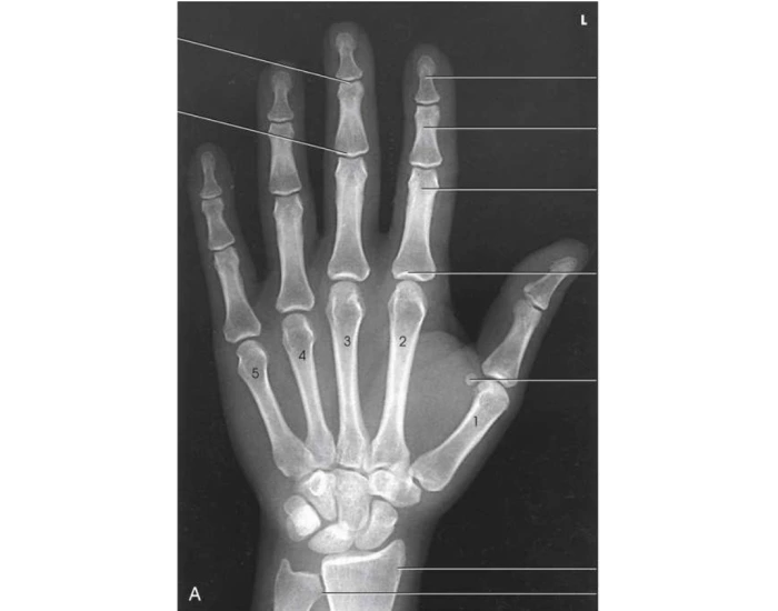 AP Hand Identification Quiz