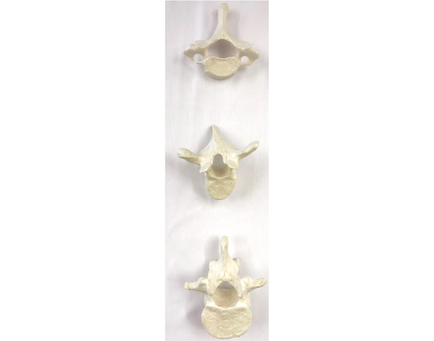 Axial Skeleton Vertebrae Location Printable Worksheet