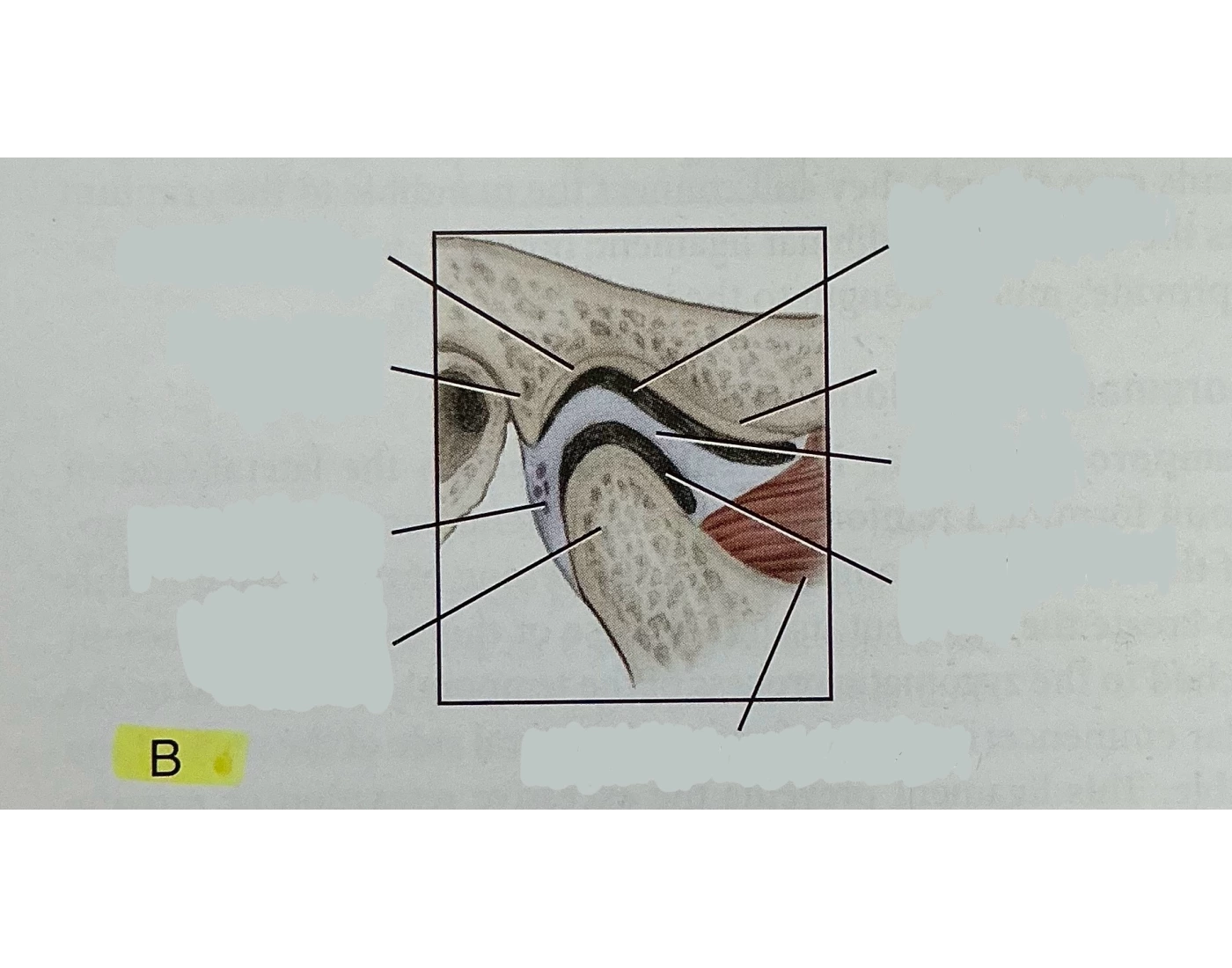 Block Dissection block dissection Quiz