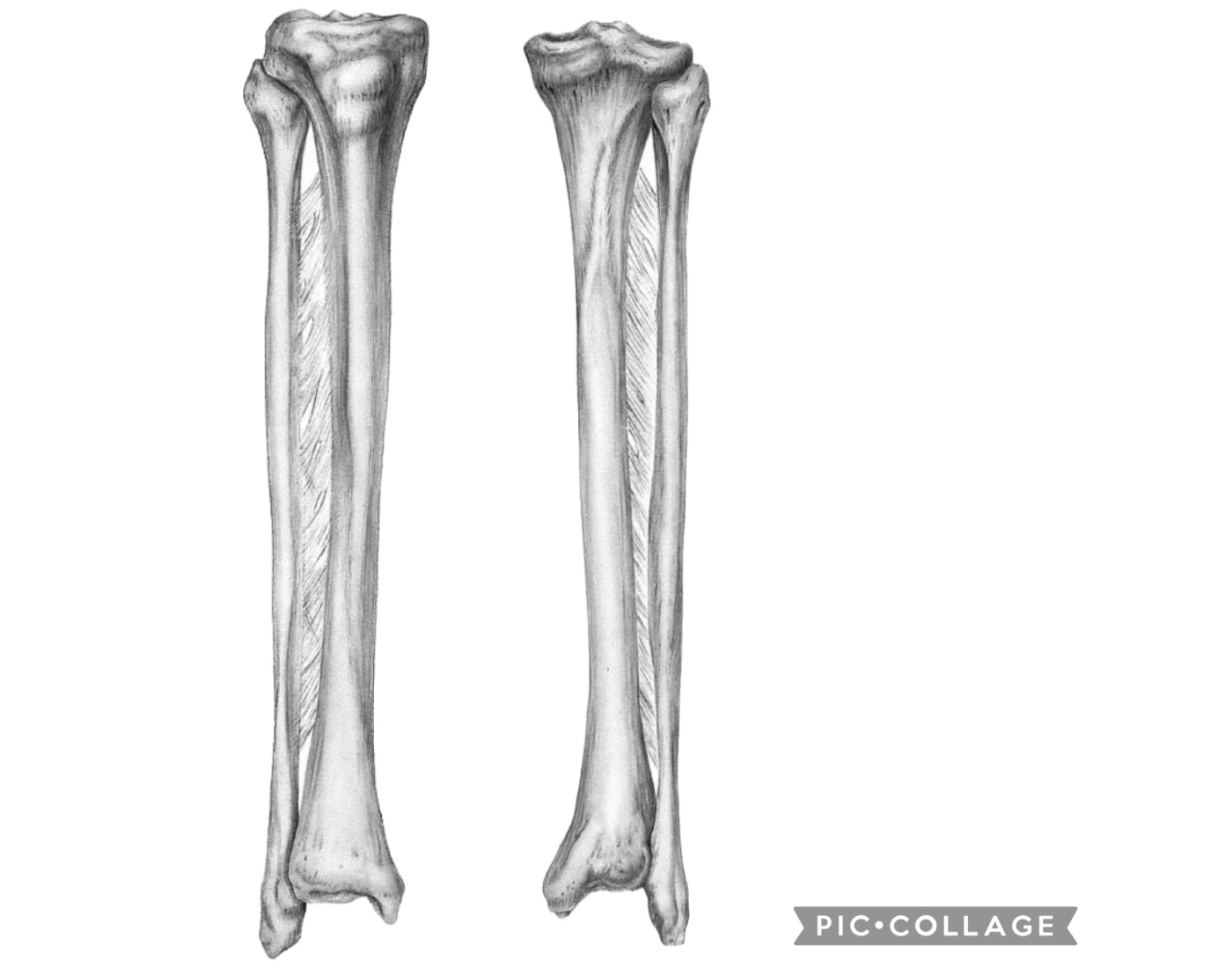 Tibia and fibula — Printable Worksheet