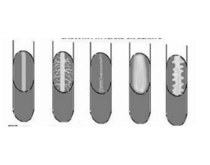 Slant Scan Pattern slant growth patterns Quiz