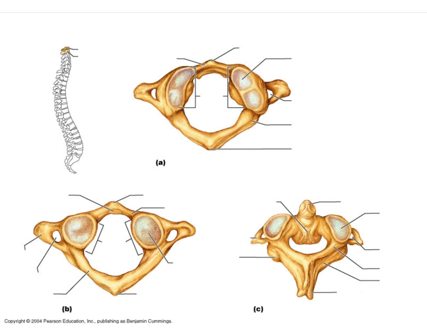 Atlas and Axis bone markings Quiz
