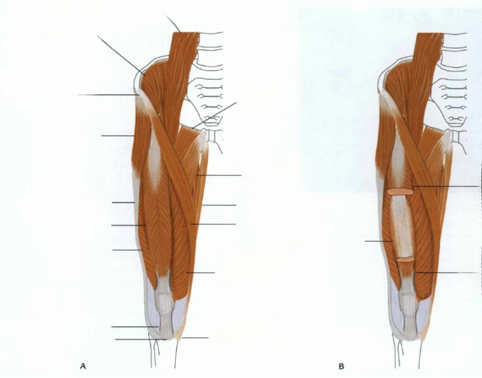 L rets Muskler FORSIDE Quiz l-rets-muskler-forside-quiz