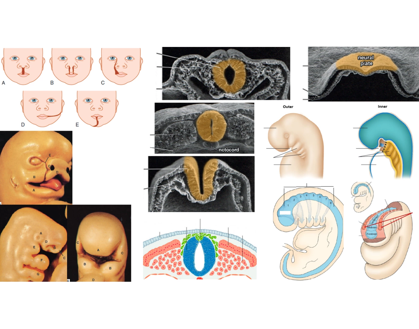 Embryology labels Printable Worksheet Embryology labels Printable Worksheet