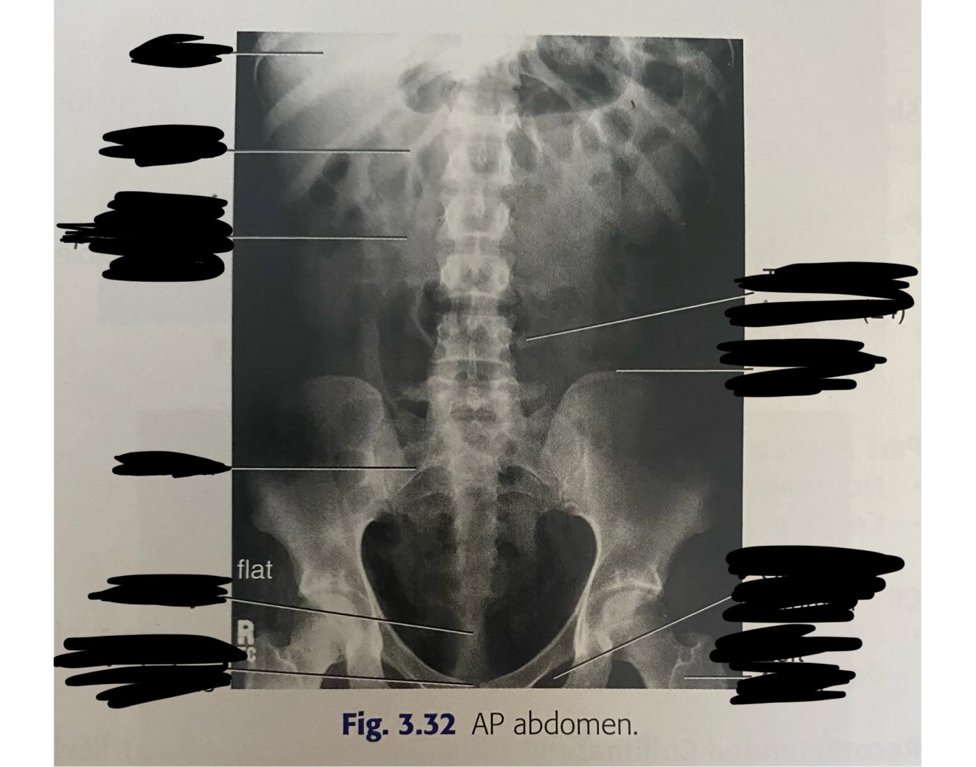 AP abdomen labeling Quiz