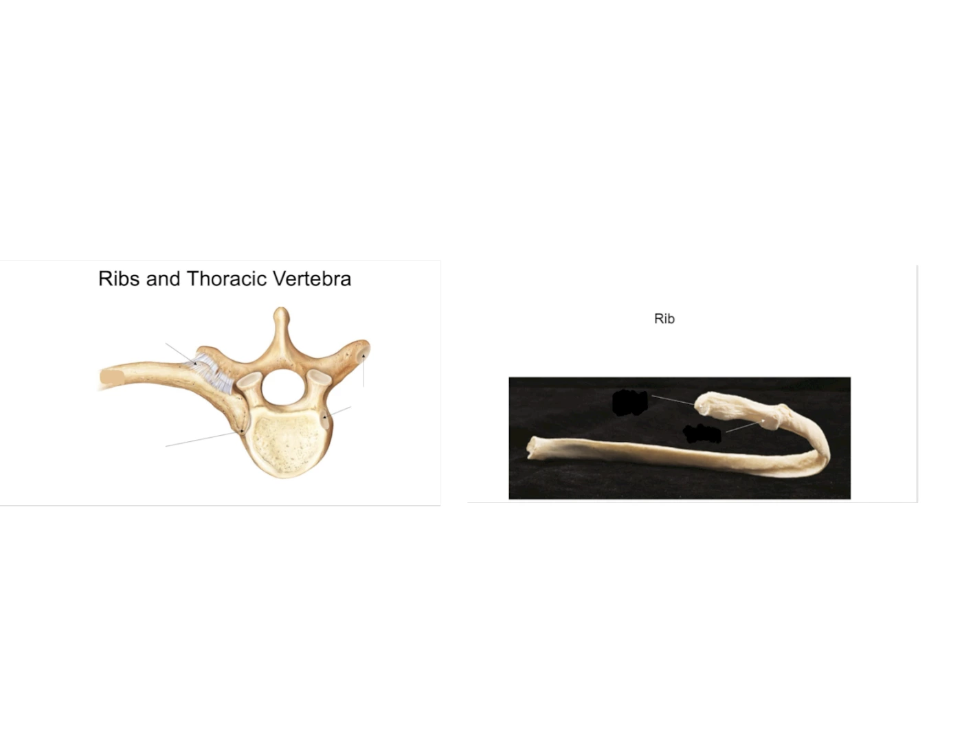 ribs and thoracic vertebra — Printable Worksheet