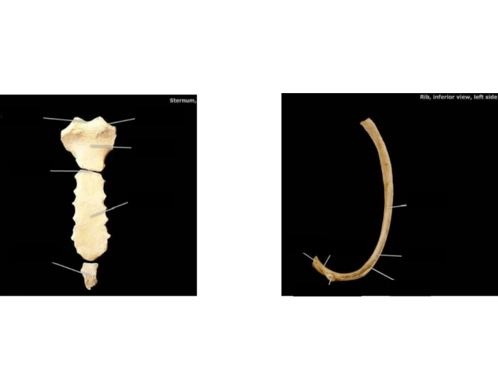 Left Rib Inferior View STERNUM AND RIB INFERIOR VIEW LEFT SIDE Quiz
